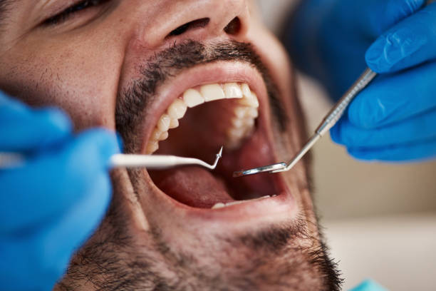 Best Same-Day Dentist Appointment  in Claremont, NC